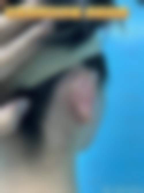 北京煤炭总医院医学美容整形中 心李小瑜医生挂号预约攻略