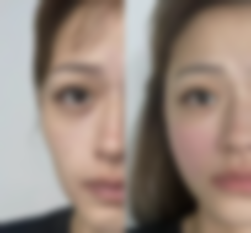 总结——商丘唯美整形医院怎么样？