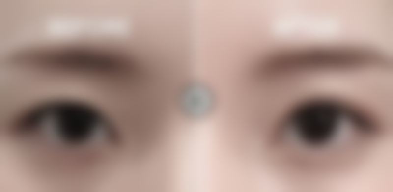 广州上美整形医院电话号码及预约方法