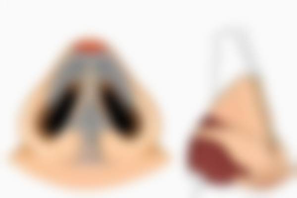 北京蕾士悦容医美伊妍仕1mL鼻唇沟再生材料项目有哪些优势？