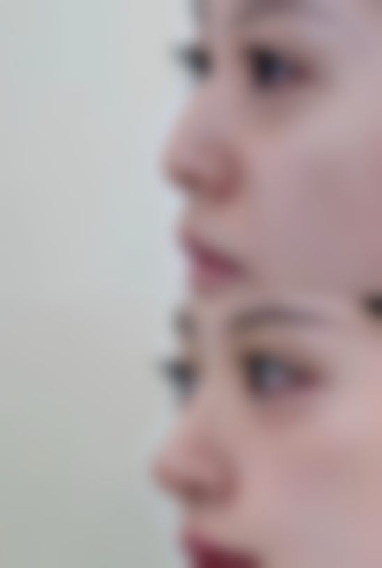 总结——日本山本美容外科医院怎么样？