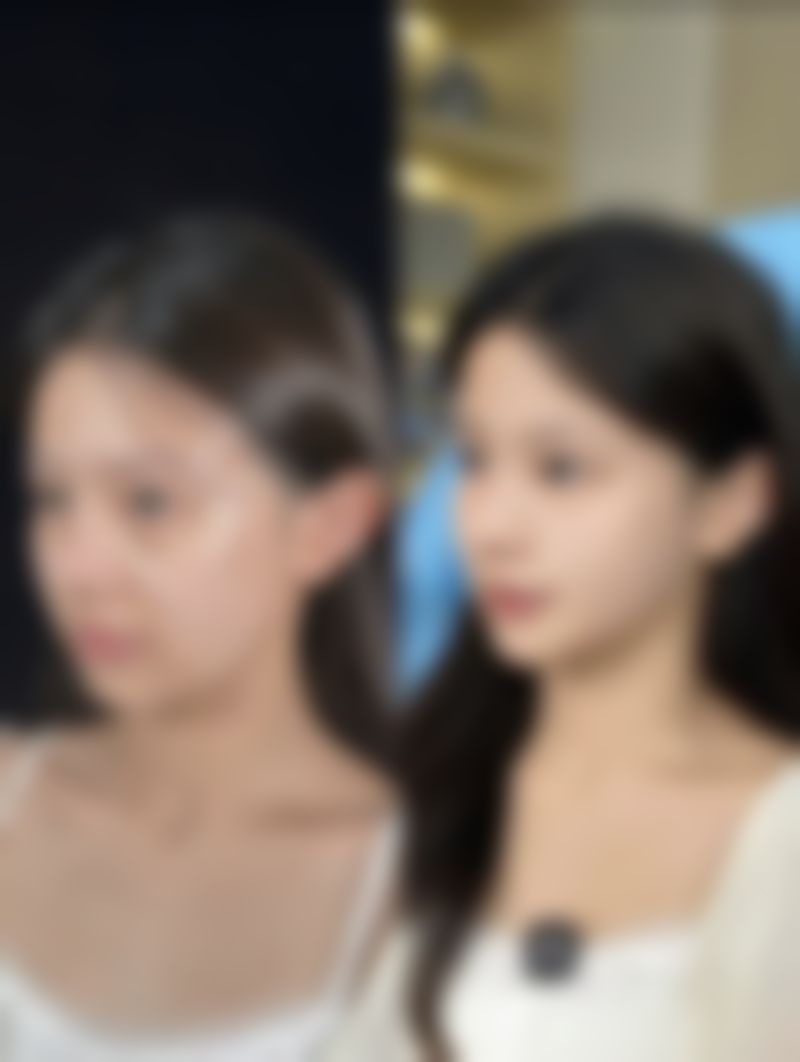 日本山本美容外科医院医院技术好不好？