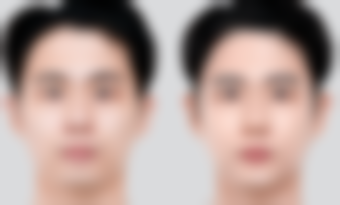 广州积美医疗美容门诊部王金芳医生挂号预约攻略