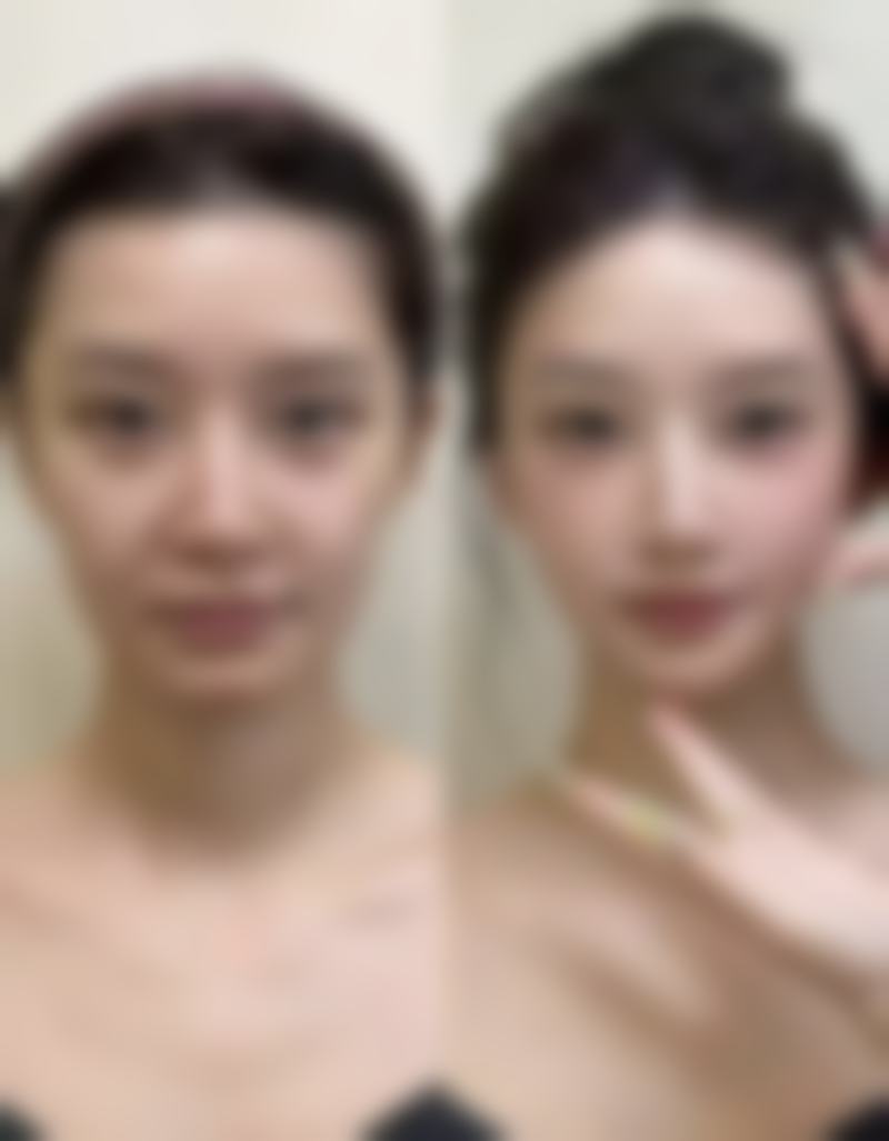 深圳可维医疗美容诊所收费标准参考