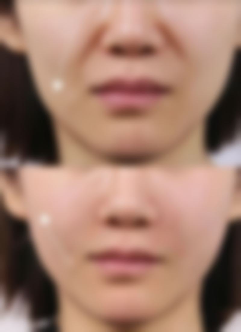 黔南州中医院医学美容科口碑如何？