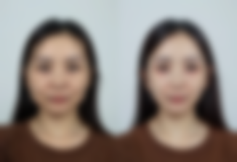 天津市人民医院整形外科口碑如何？