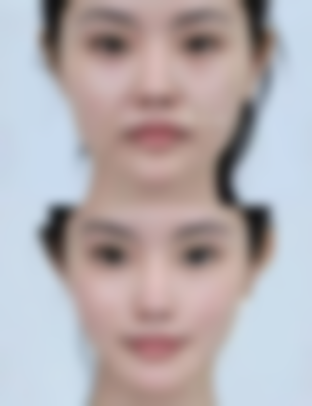 黔南州中医院医学美容科医院技术好不好？