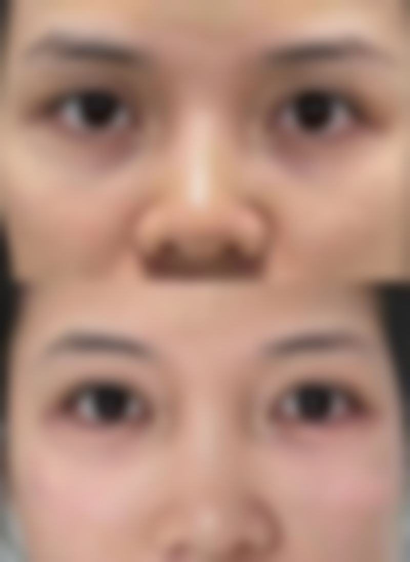 贞韩植发尹炜能医生技术好不好？