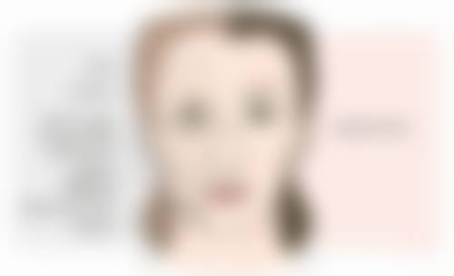 西安丽薇达医疗美容诊所医院技术好不好？