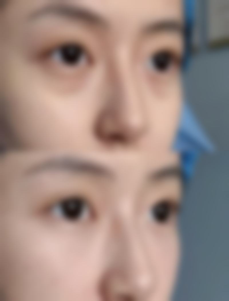 总结——珂美半**纹眉纹绣（广西柳州店）怎么样？