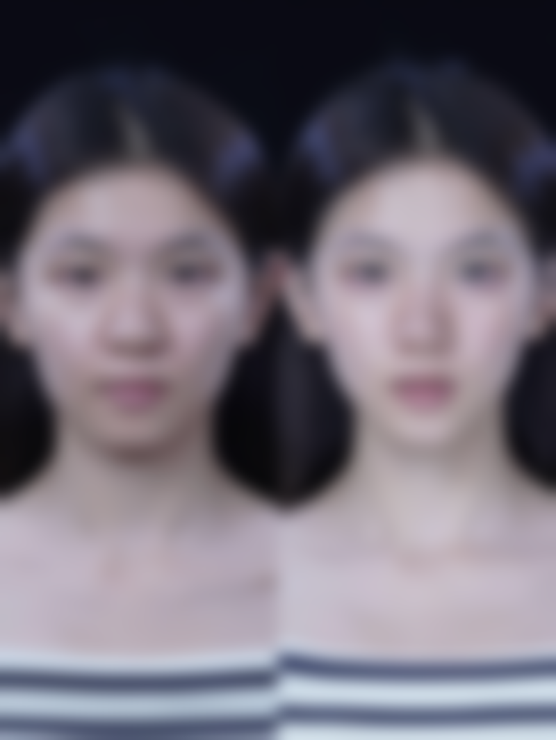 北京西美医疗美容医院医院技术好不好？