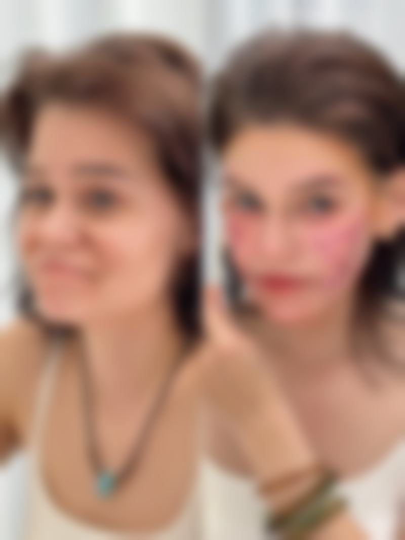 总结——韩国365mc医院吴泰燮(新村兰斯院长)医生怎么样?