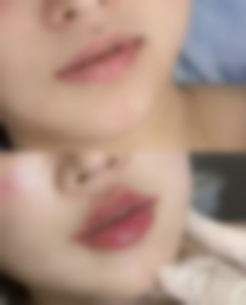 成都逆龄社整形医疗美容诊所口碑如何？