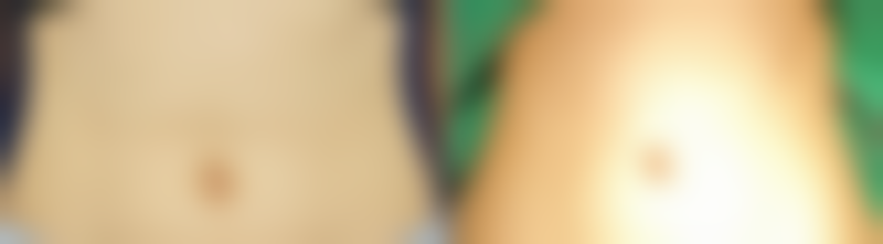 总结——福建医 科 大学附属福州市第一医院(整形外科)怎么样？