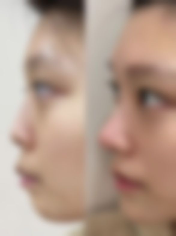 总结——广州荔医医疗美容门诊部樊哲祥医生怎么样？