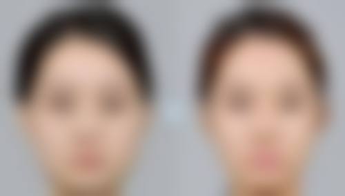 西安瑞碧特医疗美容诊所口碑如何？