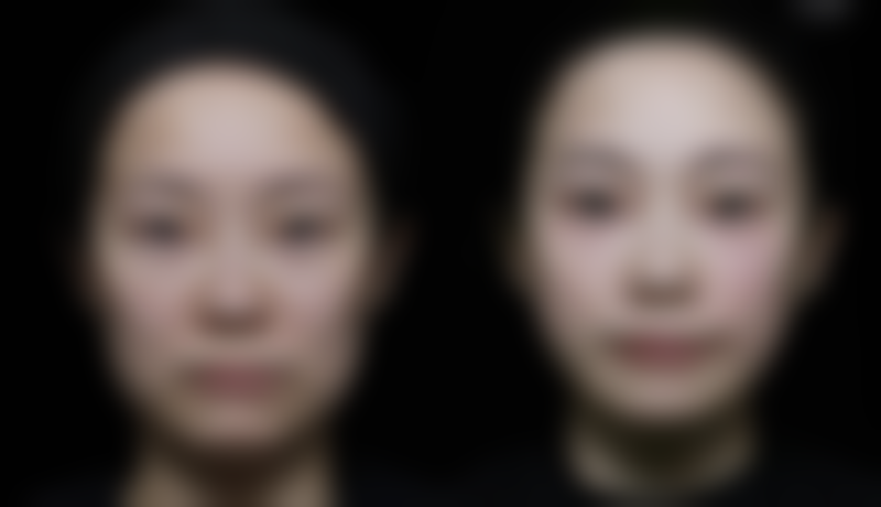 青岛海伦植发医院整形科医院技术好不好?