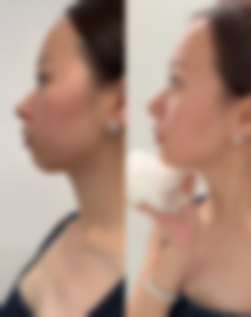 深圳星美妍医疗美容诊所收费标准参考