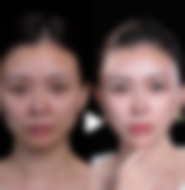 成都鹏爱悦己医疗美容医院口碑如何？