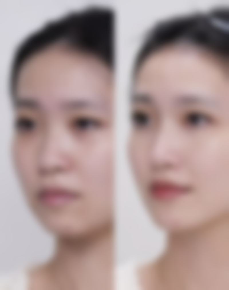 西安瑞碧特医疗美容诊所医院技术好不好？