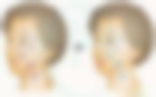 总结——韩国365mc医院金相润（仁川院）医生怎么样？