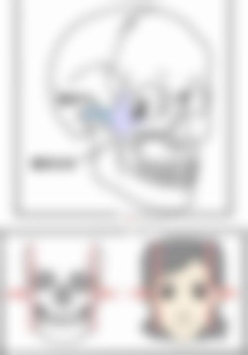 总结——成都easySCULPT怡脂整形怎么样？