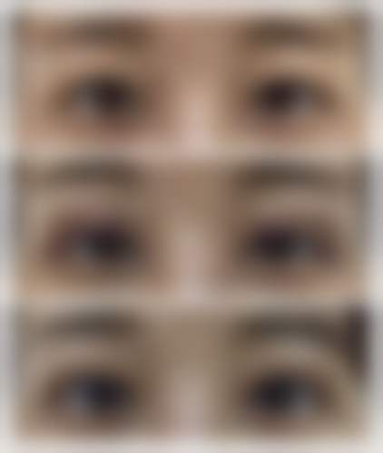 总结——上海丽保佳(保加)医疗美容门诊部王丽珊医生怎么样？