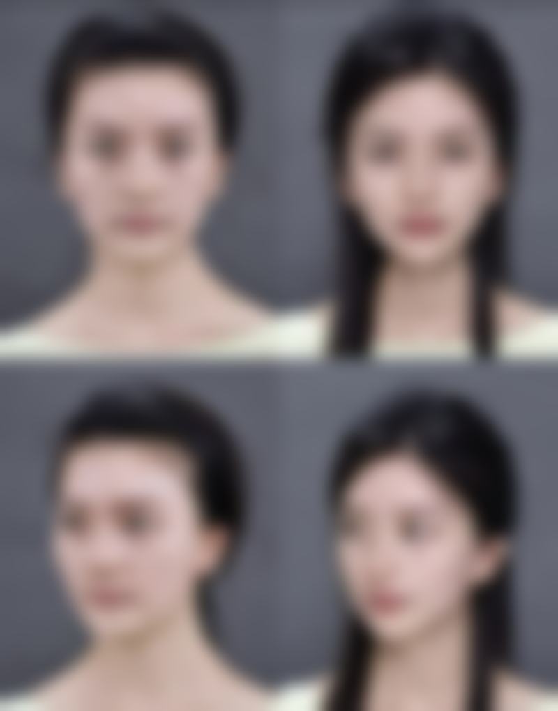 成都easySCULPT怡脂整形收费标准参考