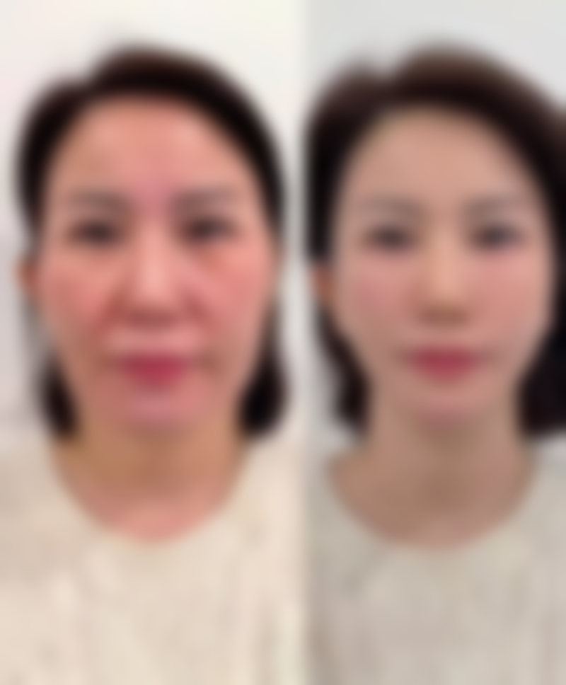 抚顺阳光医疗美容诊所口碑如何？