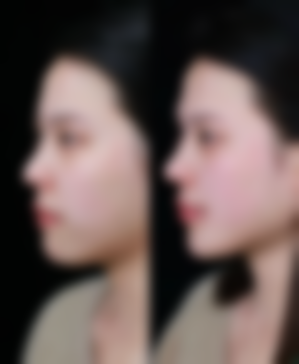 武汉华亚医疗美容医院医院技术好不好？