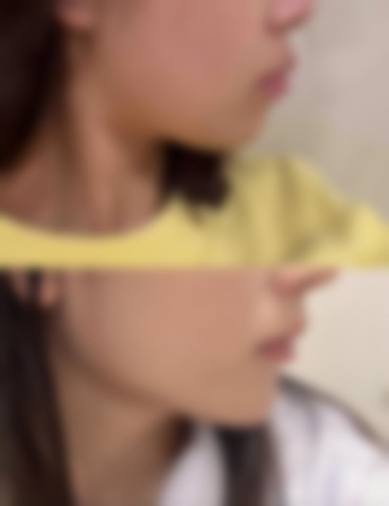 许昌协雅医疗美容门诊部收费标准参考