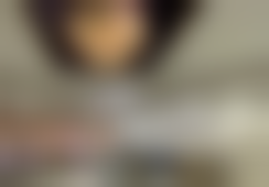 汕头曙光医疗美容整形门诊部医院技术好不好？