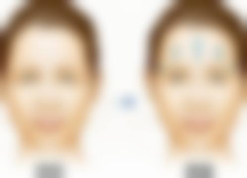 韩国首尔丽格皮肤科医院技术好不好?