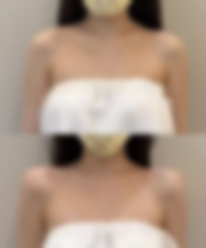 总结——南京苏王整形医院（旗舰店）贝怀年医生怎么样？