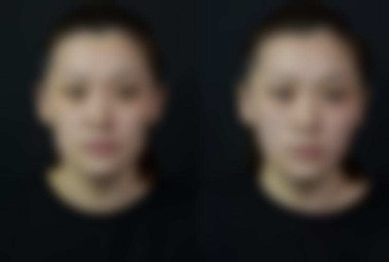 成都美辰星耀医疗美容硬件设备精良！