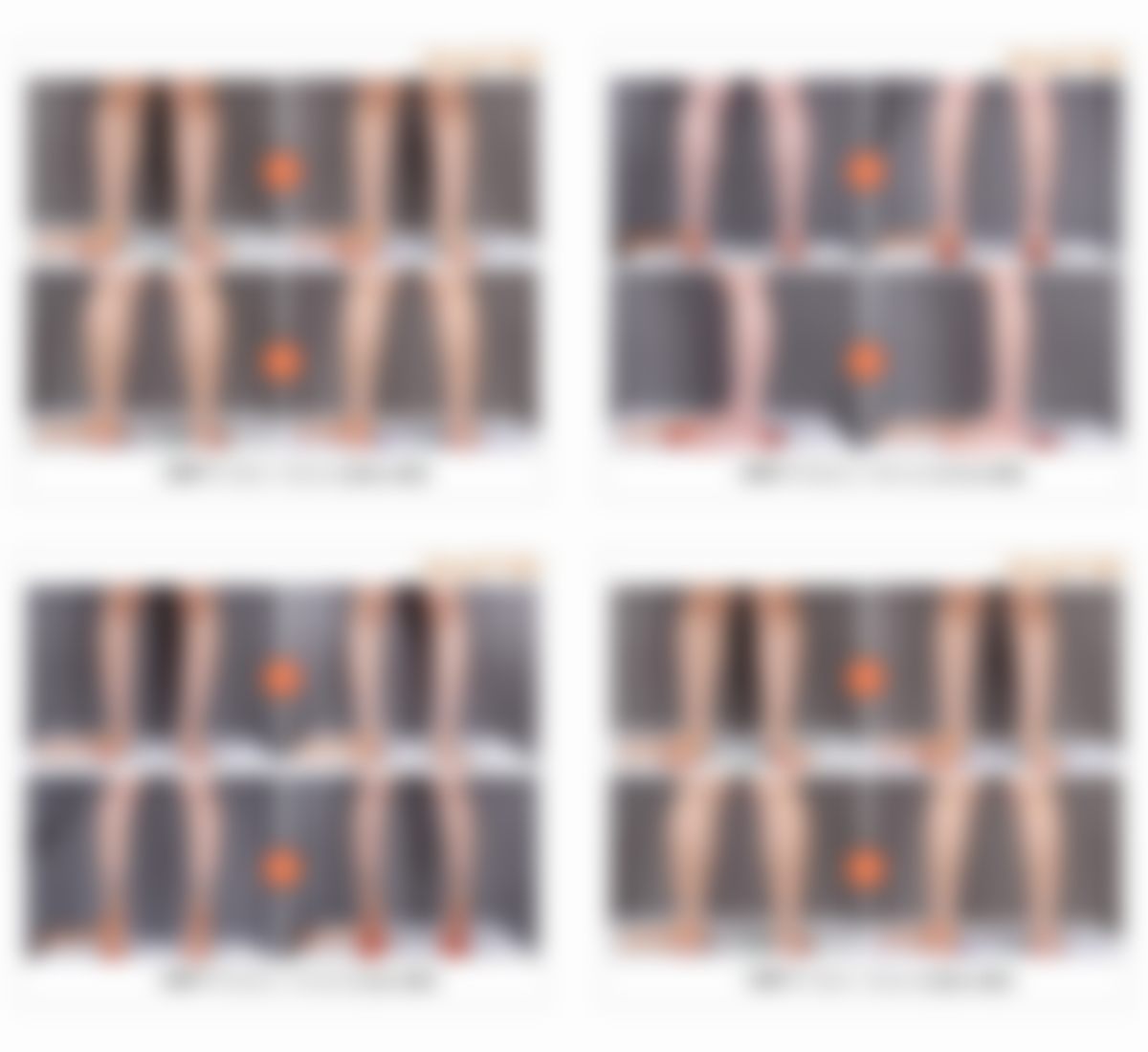 韩国365mc吸脂医院杨贤硕（日山店兰斯院长）医生口碑评价如何？