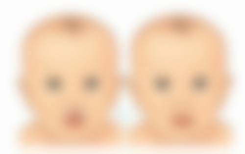 焉耆县人民医院整形美容科朱新红医生技术好不好?