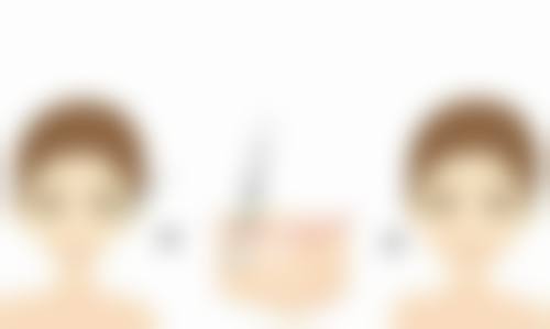 沈阳城本医疗美容诊所植发科硬件设备精良！