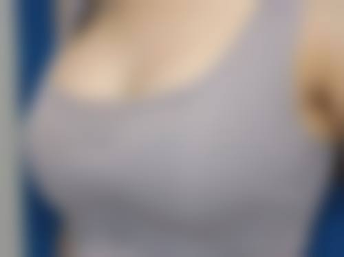 深圳蒙恩齿科诊所收费标准参考