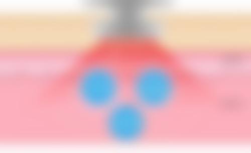 焉耆县人民医院整形美容科朱新红医生挂号预约攻略