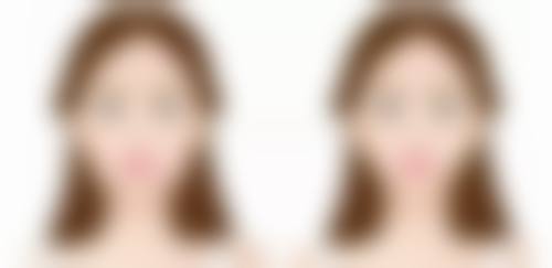 沈阳城本医疗美容诊所植发科医院技术好不好？