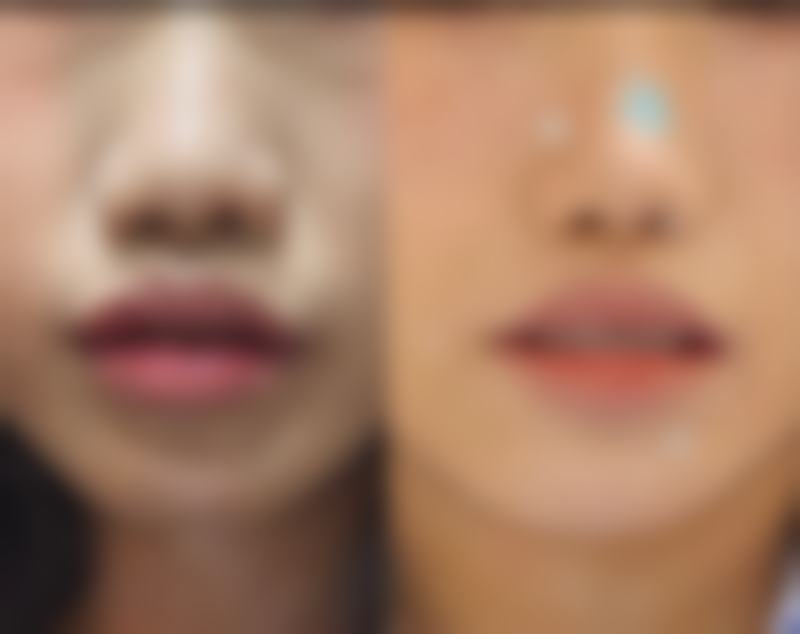 韩国科琳挞图皮肤科硬件设备精良！