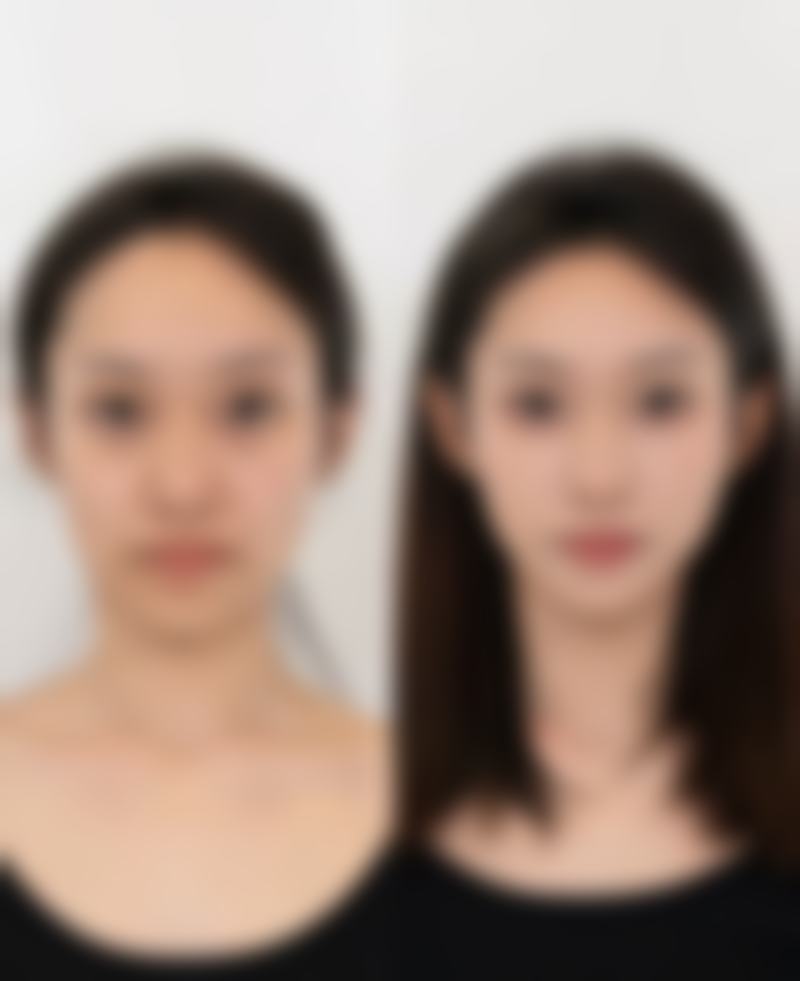 总结——焉耆县人民医院整形美容科朱新红医生怎么样?