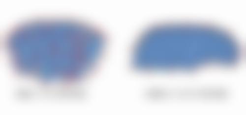 Ing整形外科收费标准参考