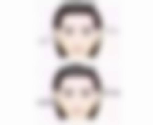 宁波奉化珐丽整形医院口碑如何？