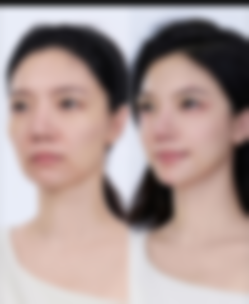 总结——浙江大学医学校附属儿童医院(烧伤整形科)怎么样？