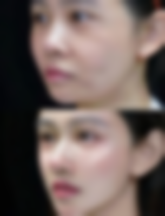 总结——Ing整形外科怎么样？