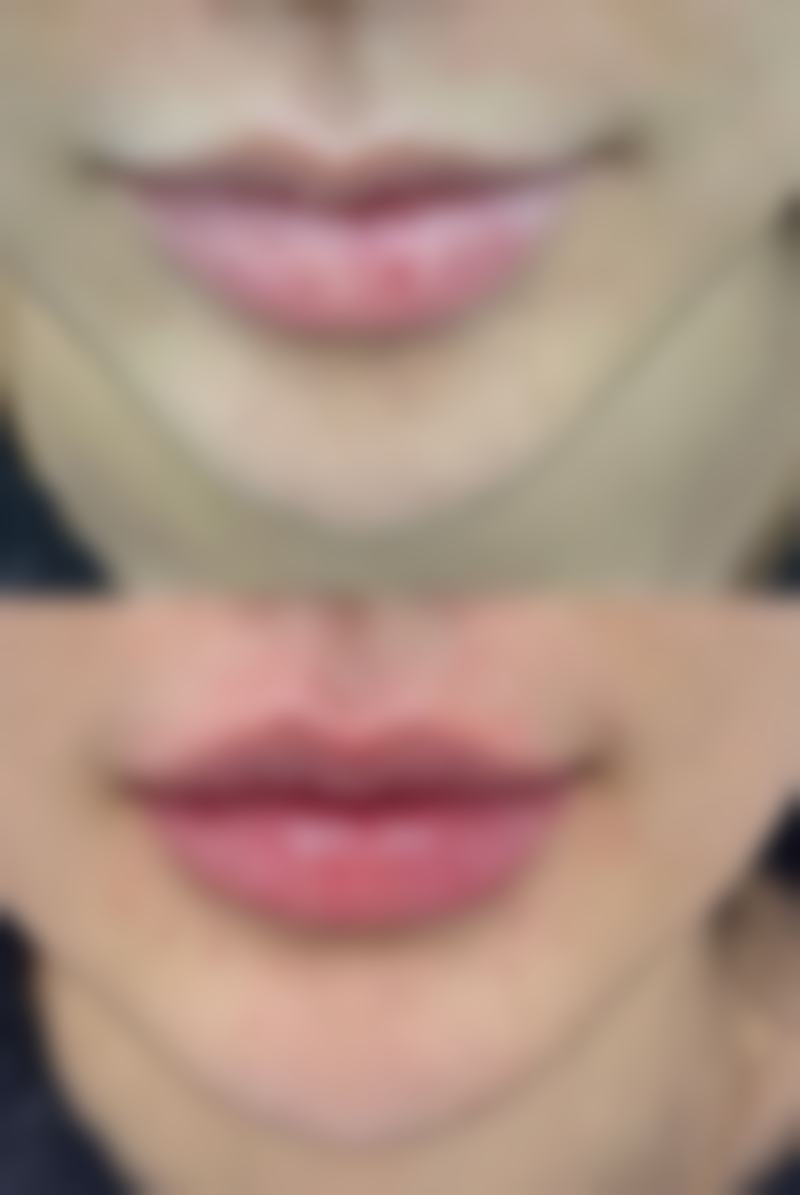 总结——内蒙古诺伊美整形医院怎么样？