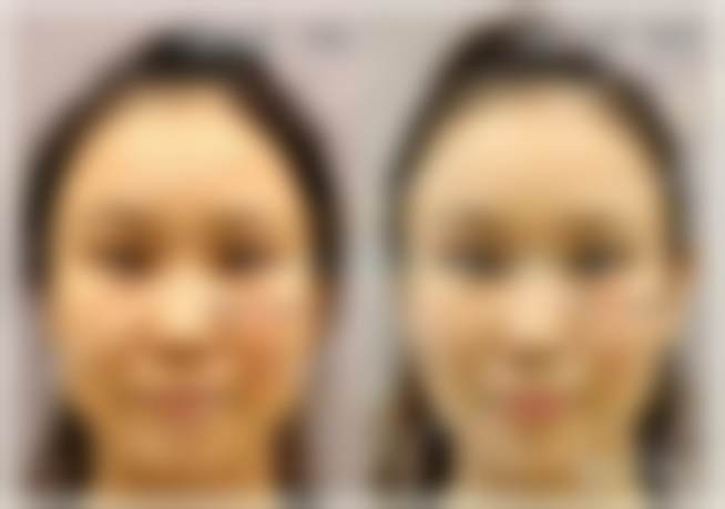 北京客来美舍张冰洁医生的经验多吗？