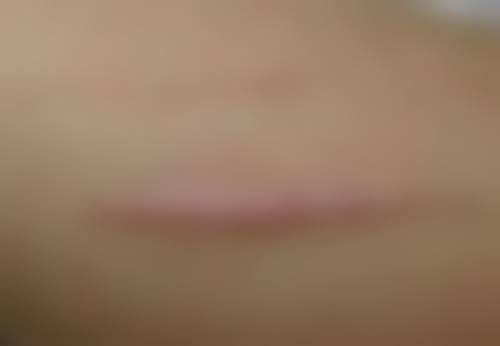 广州丽尚医疗美容门诊部邓海霞医生挂号预约攻略